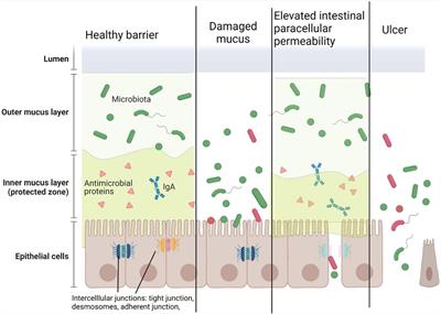 The Influence of Nutrition on Intestinal Permeability and the Microbiome in Health and Disease